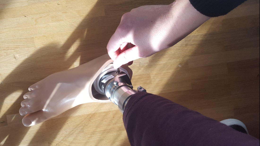 Beinprothese Unterschenkel