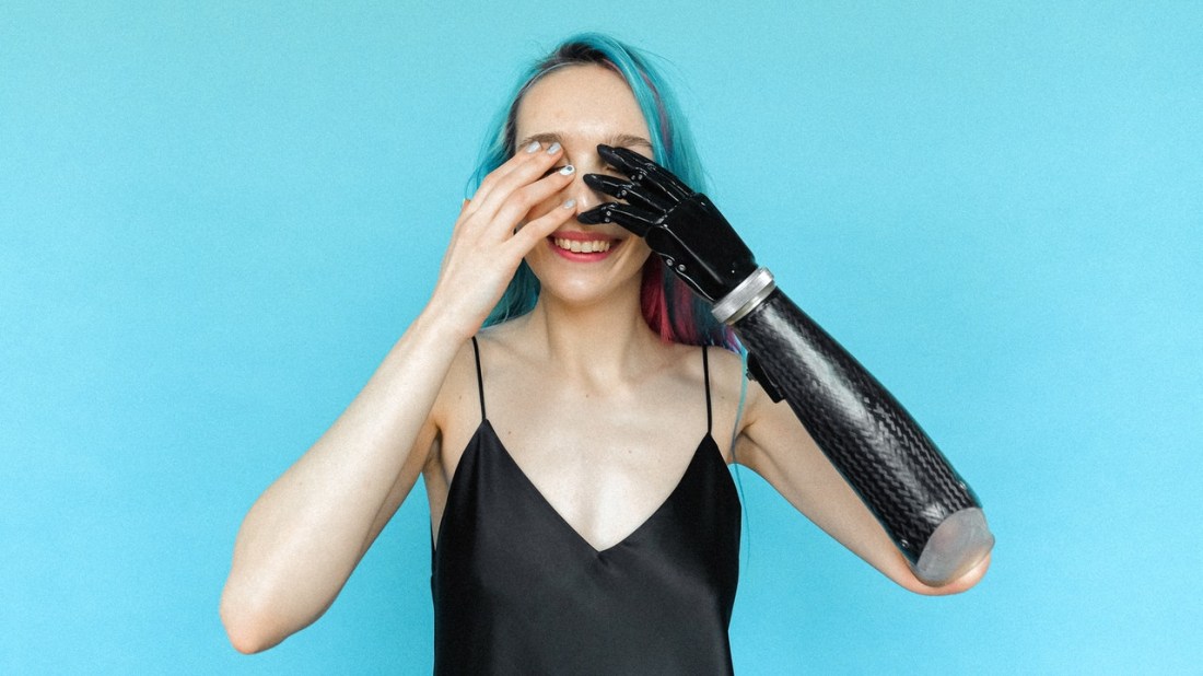 Frau mit Armprothese