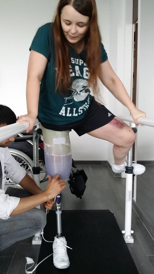 Anwenderin mit Beinprothese