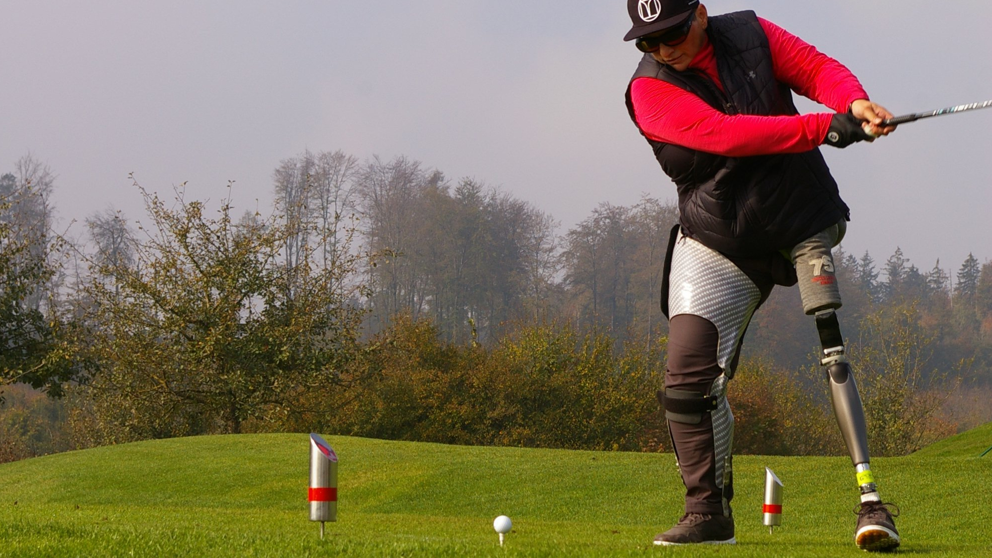 Beinamputierte Anwenderin mit Hüftex