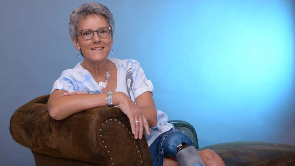 Anwenderin mit Endo-Exo Beinprothese