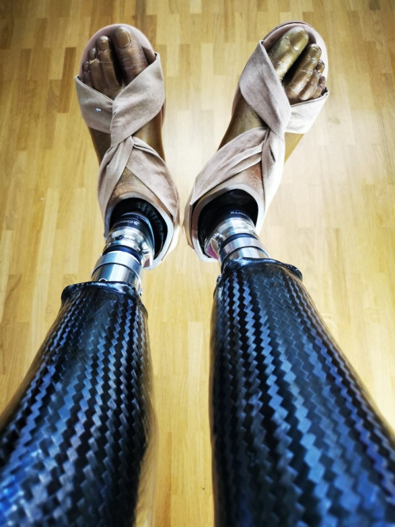 2 schwarze Beinprothesen aus Carbon mit Fußkosmetik-
Perspektivenwechsel mit Prothesen